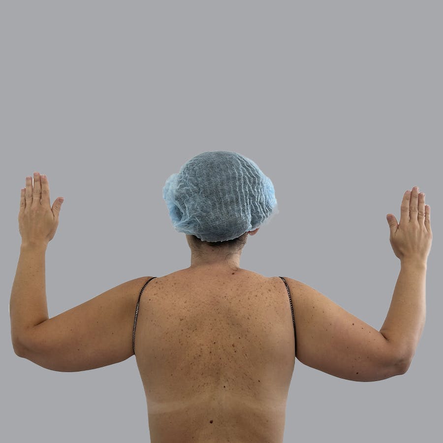 procedure