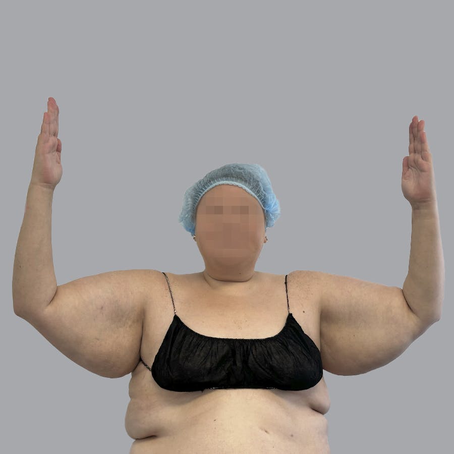 procedure