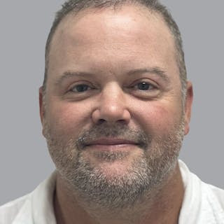 Eyelid Surgery Before & After Gallery - Patient 491388 - Image 2