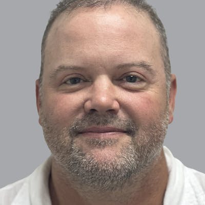Blepharoplasty in Tampa Before & After Gallery - Patient 491388 - Image 2