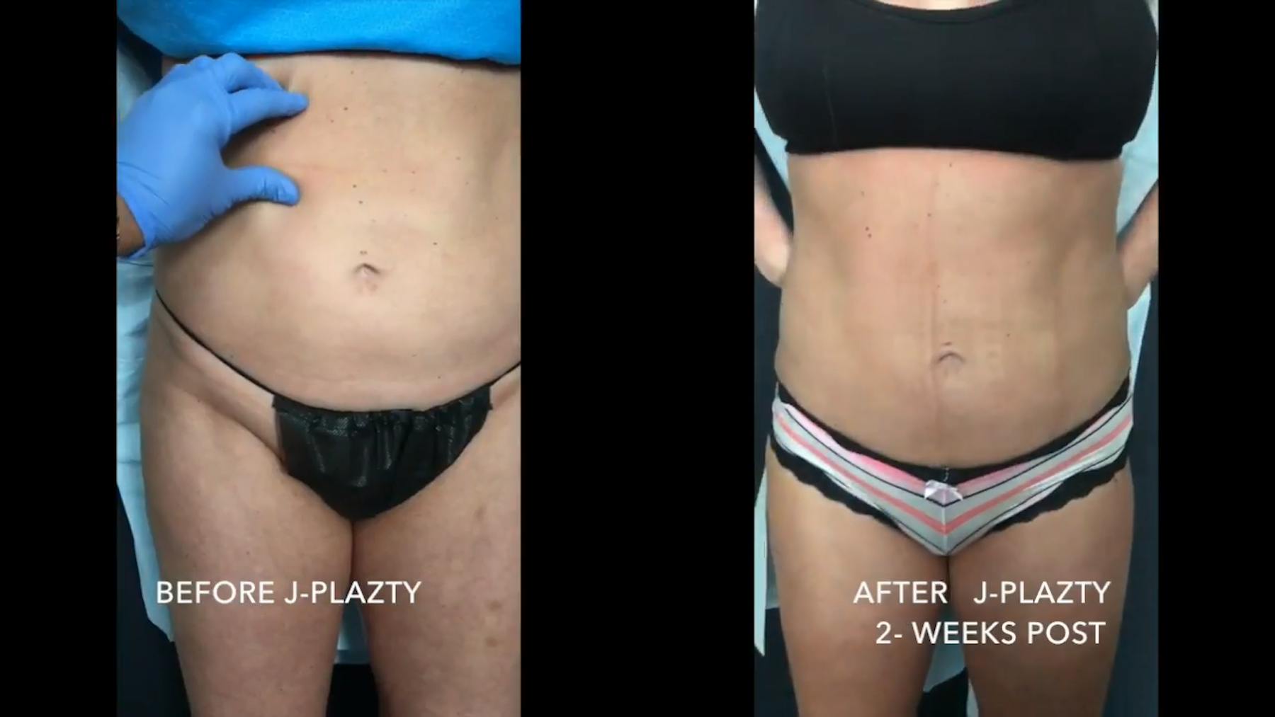 Virginia Institute of Plastic Surgery