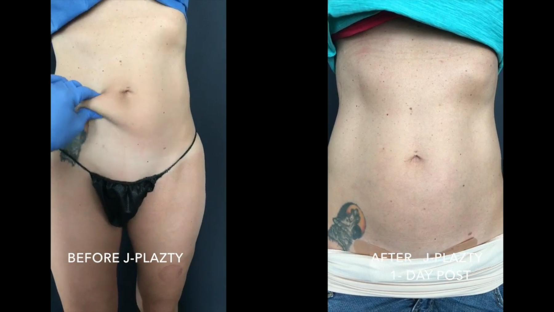 Virginia Institute of Plastic Surgery