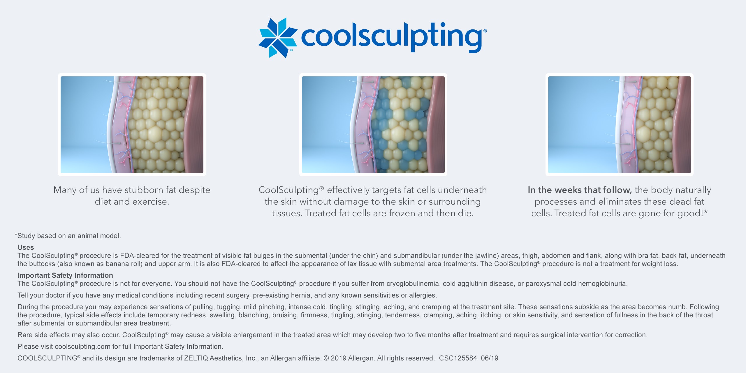 how coolsculpting works