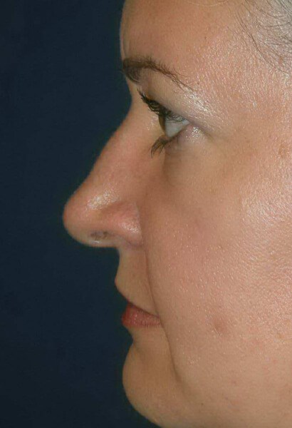 Woman's Profile