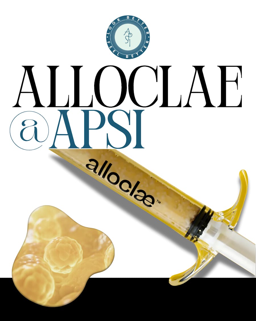 AlloClae