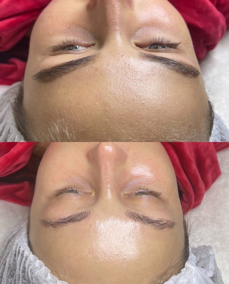 Медово ензимний спа-догляд