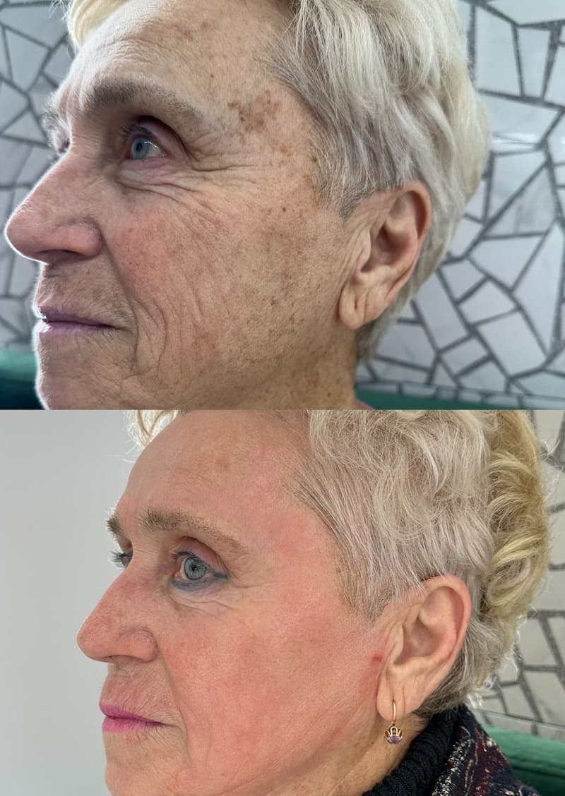 Комбіноване шліфування