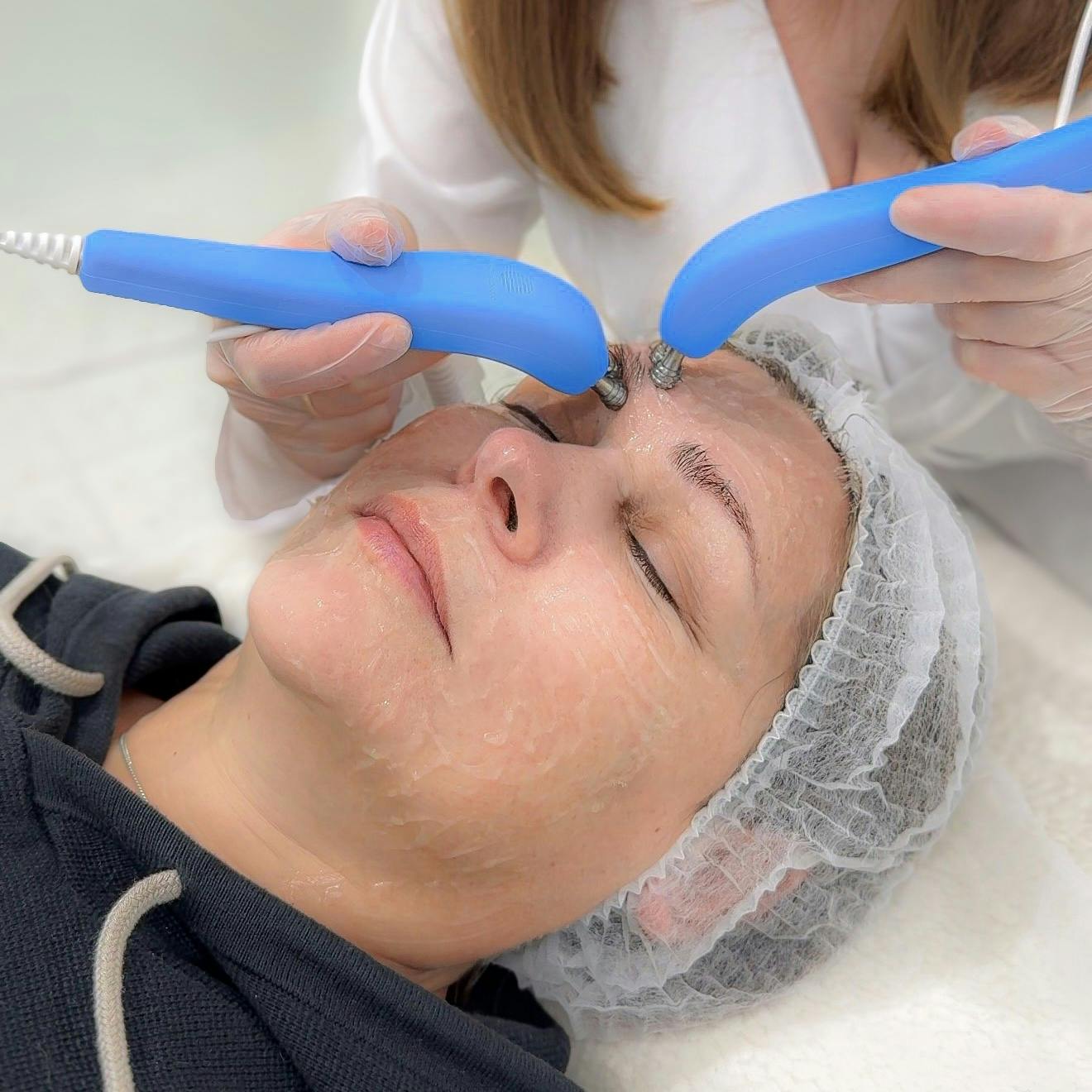 Мікрострумова терапія