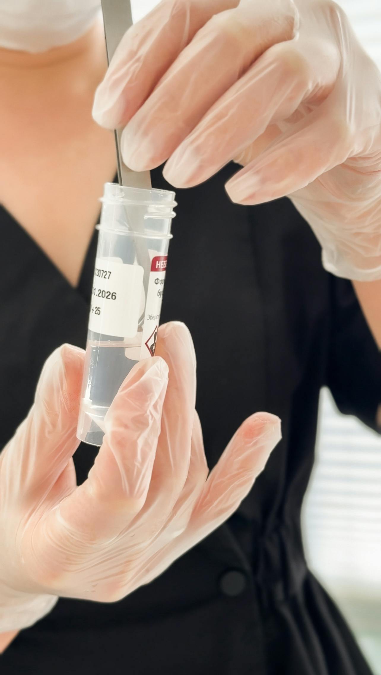 Гістологічне дослідження новоутворень