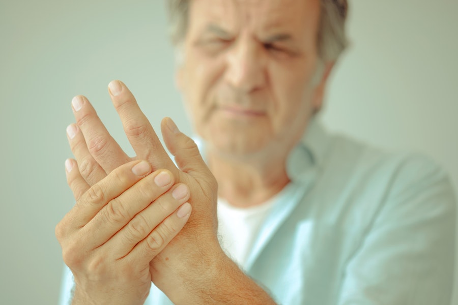 Finding the optimal CBD dose for rheumatoid arthritis