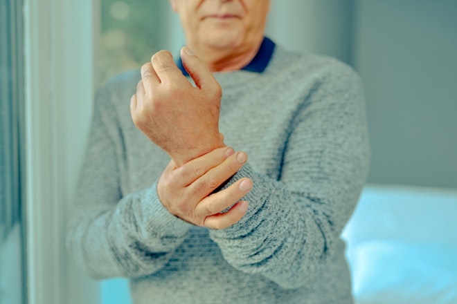 Finding the optimal CBD dose for rheumatoid arthritis