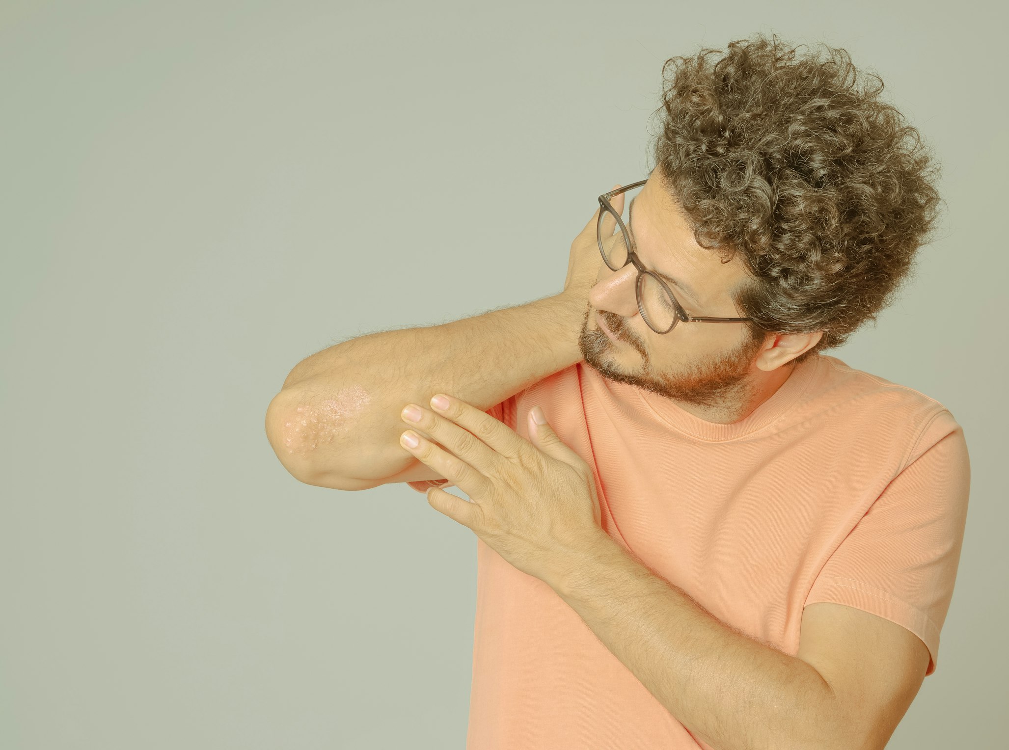 Unlocking the benefits of CBD oil for psoriasis