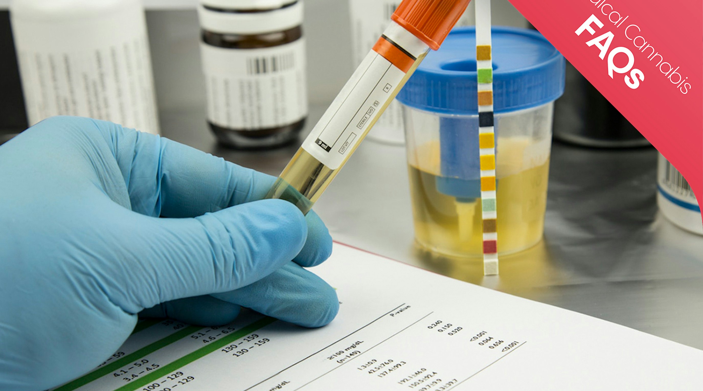 Medical cannabis treatment concept showing cannabis leaves and a stopwatch highlighting duration in the system