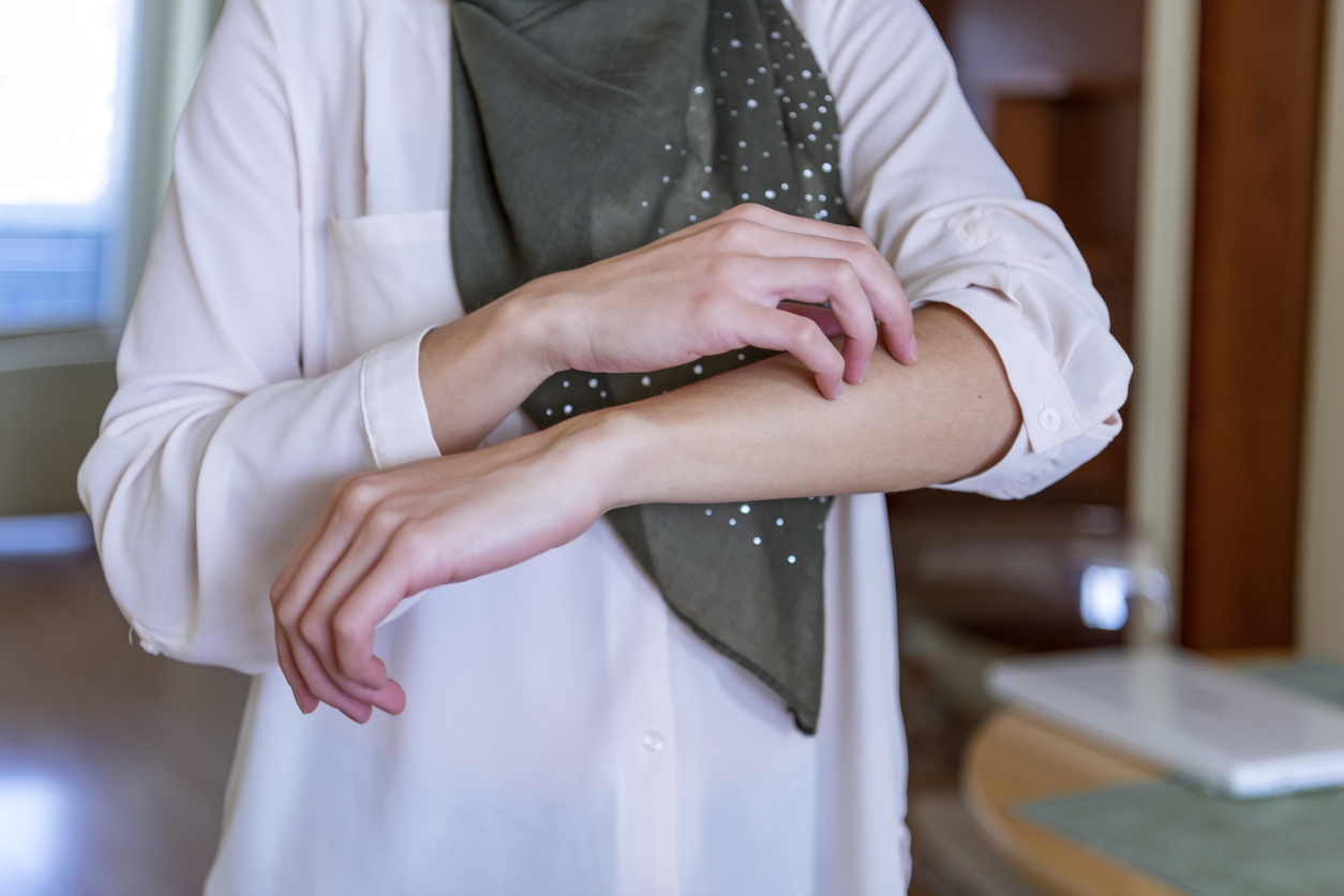 What is Psoriasis?
