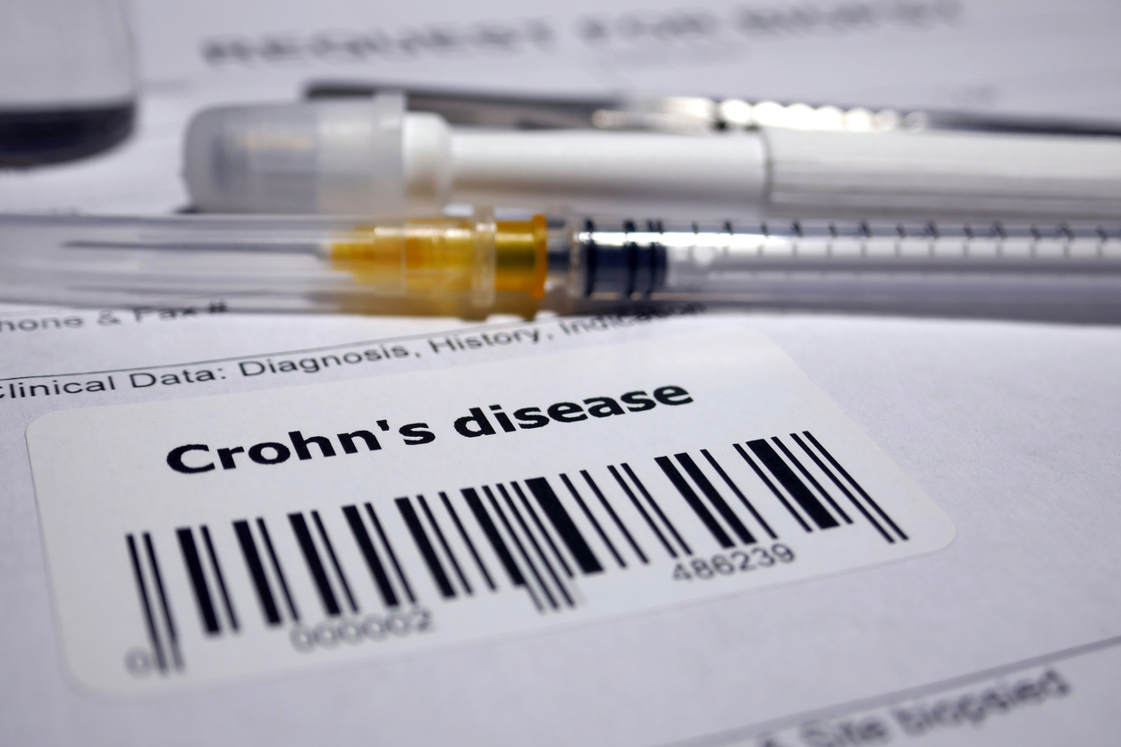 Research studies on CBD and Crohn's disease