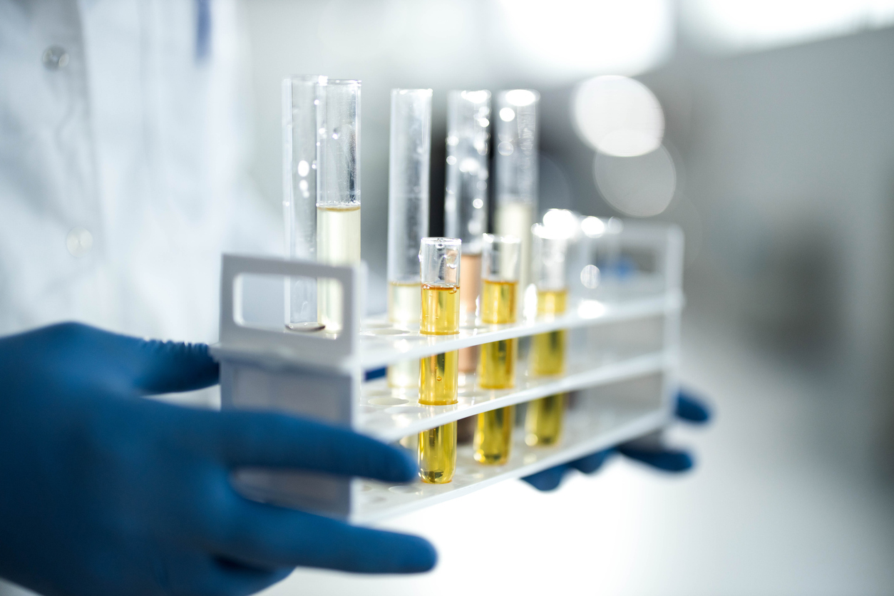 How does medical cannabis oil work
