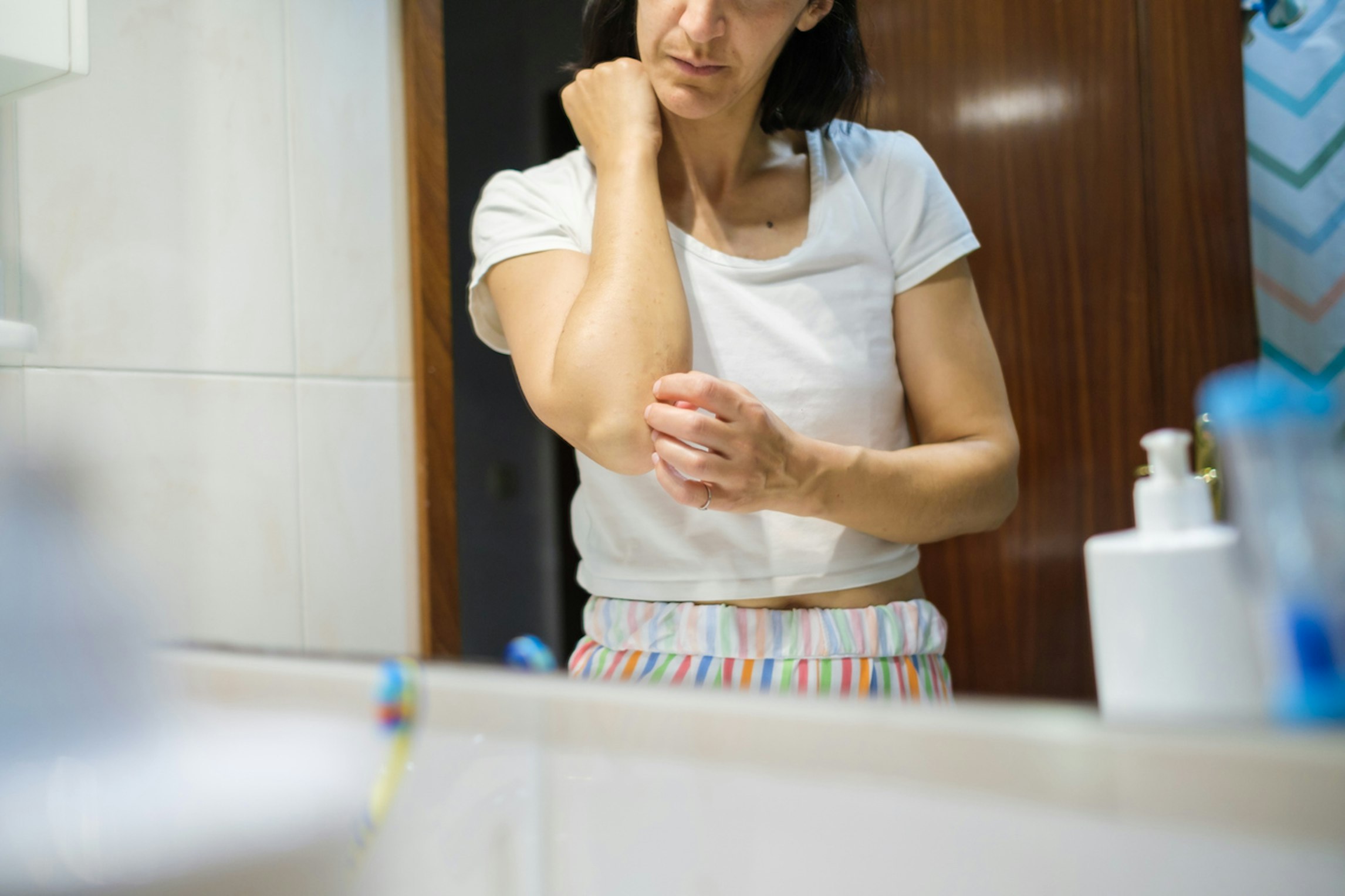 Psoriasis and medical cannabis treatments
