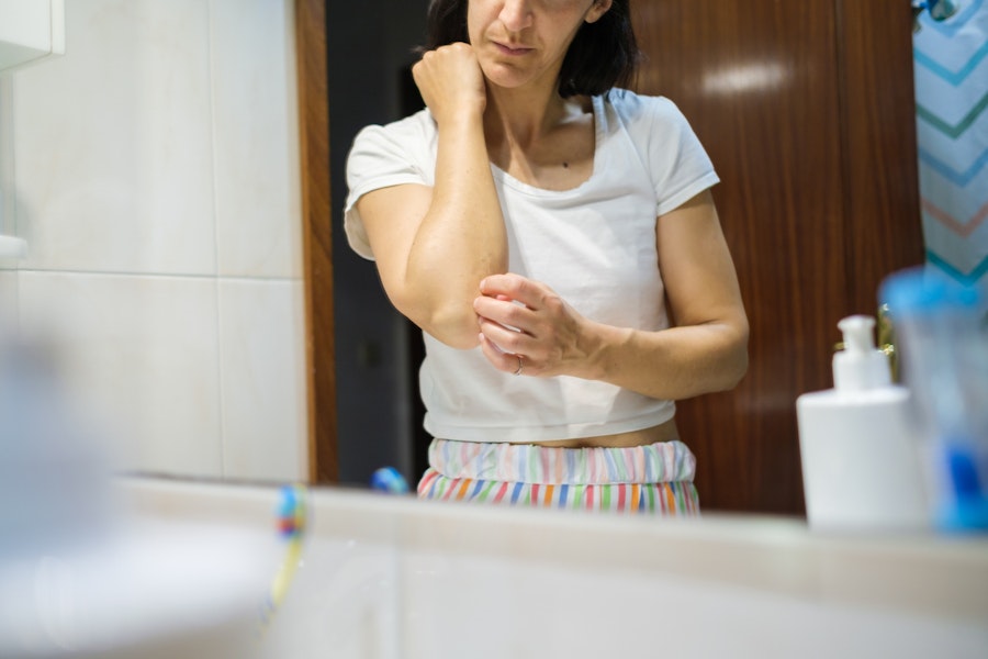 Psoriasis and medical cannabis treatments