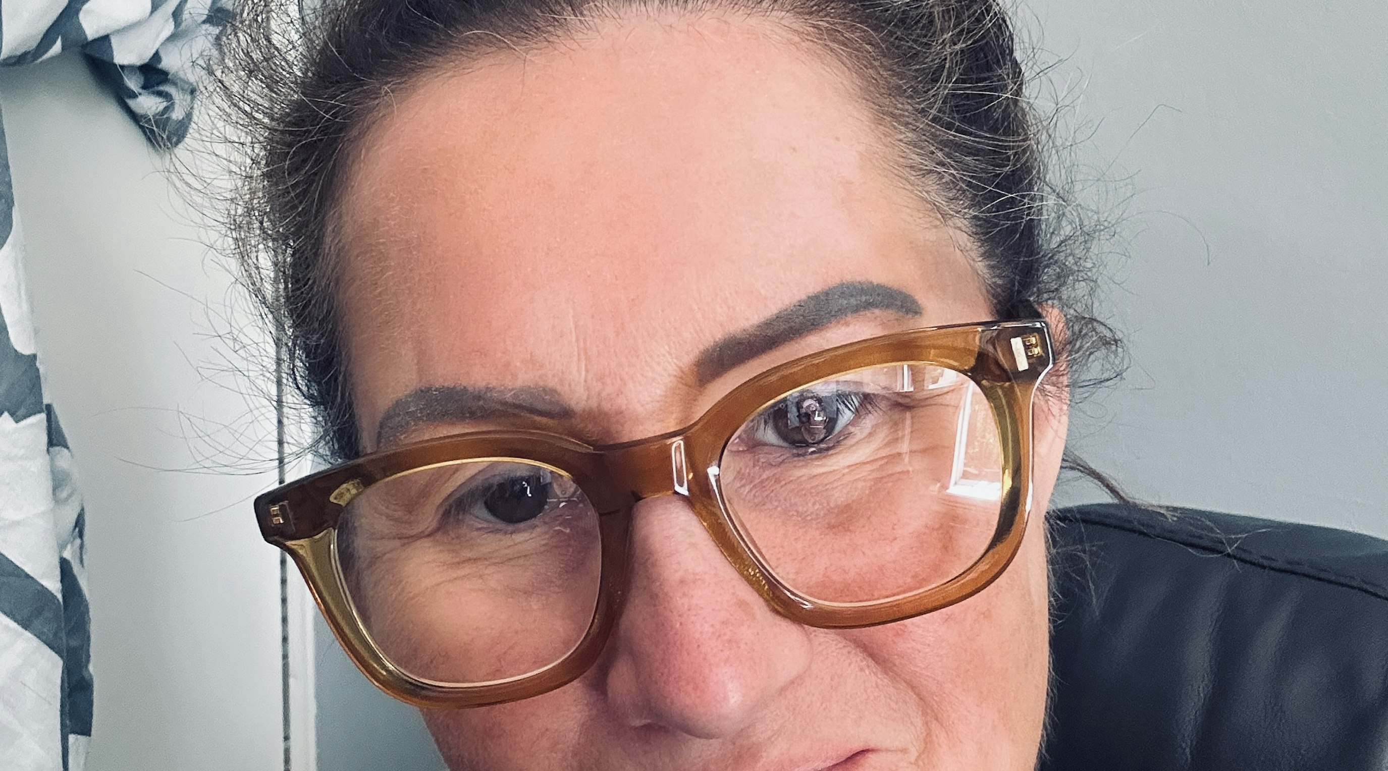 Jacqueline Daley Patient Story Jacqueline Daley Patient Story