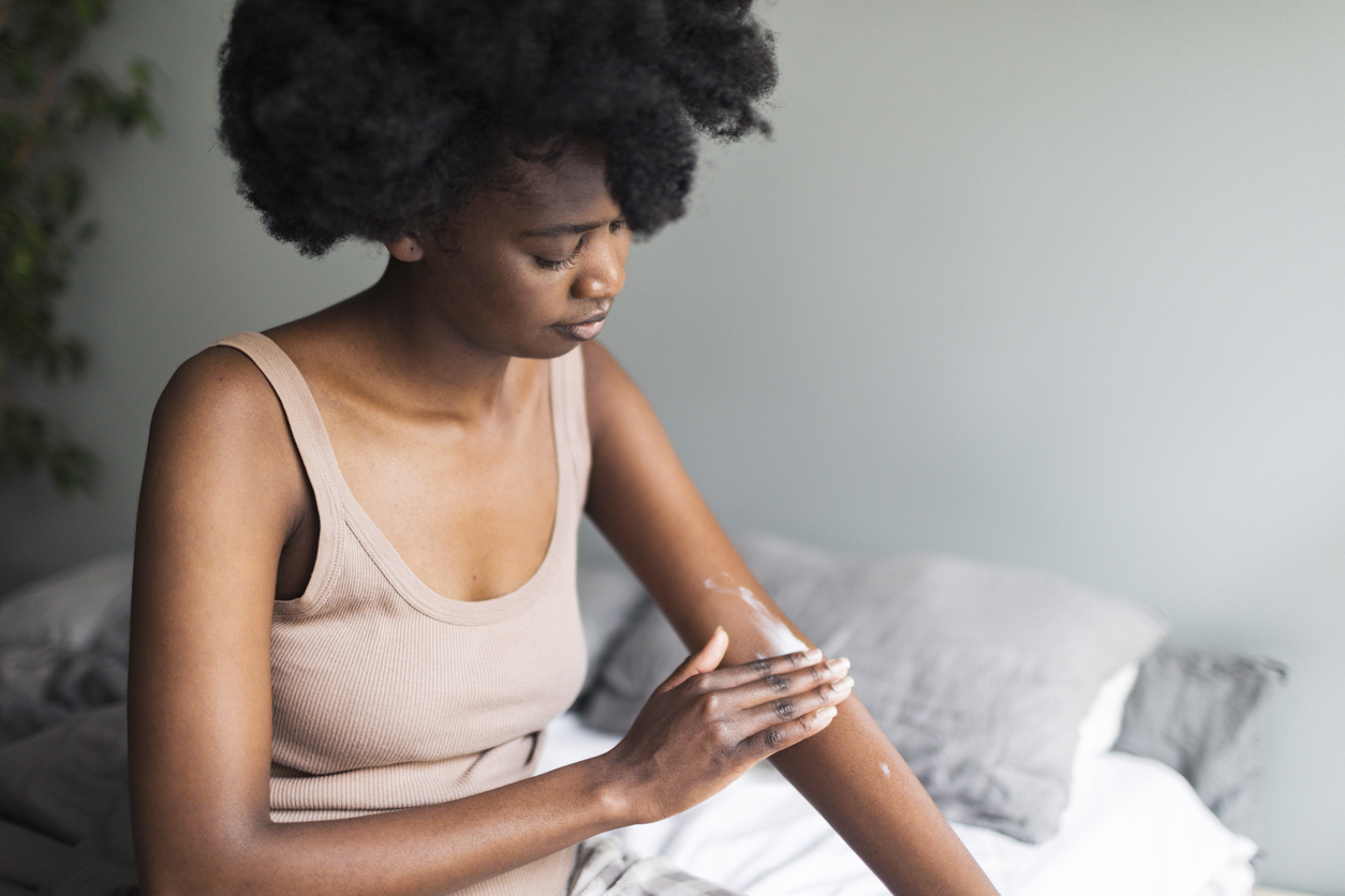 Hemp cream for psoriasis
