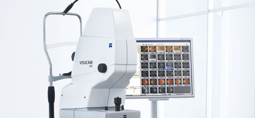 Fluoroangiografia retinica