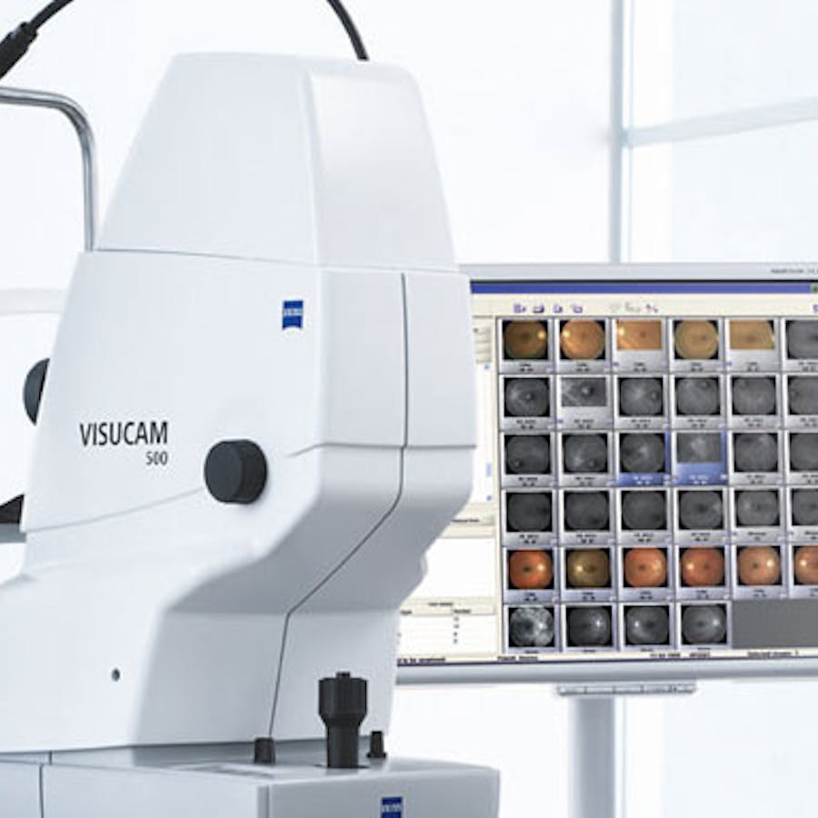 Fluoroangiografia retinica