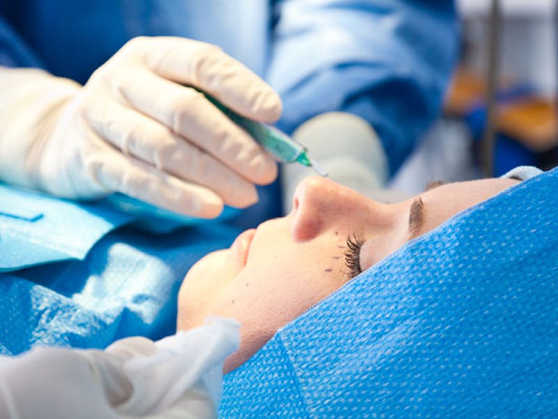 1553764374 cirugia oculoplastica que es