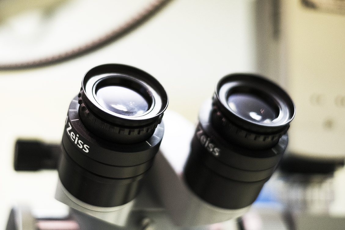 Intervento di cataratta