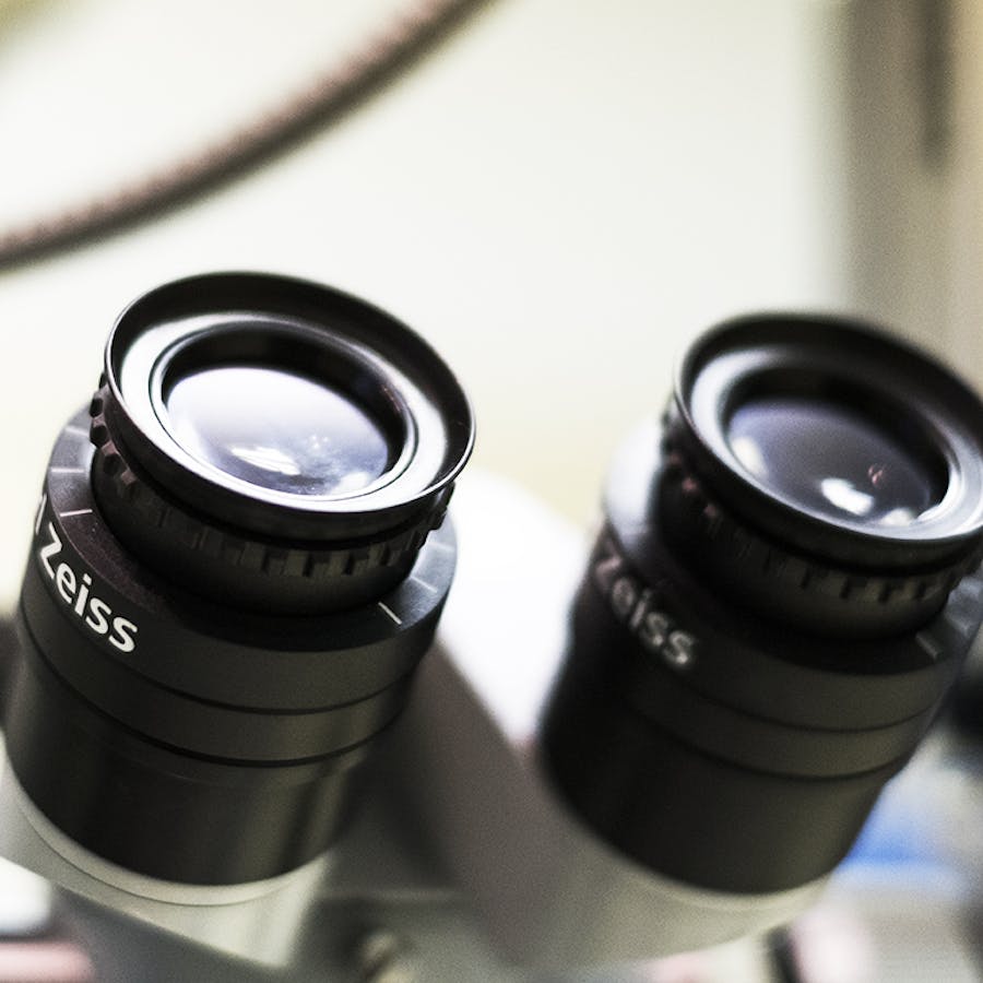 Intervento di cataratta