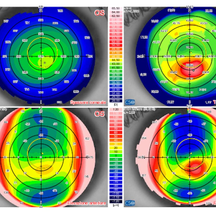 Visita Optometrica e Lenti a Contatto