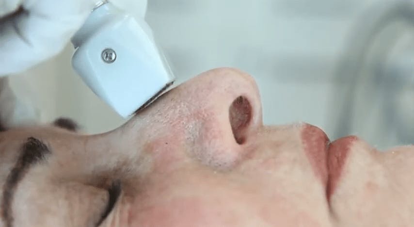 A Nose Receiving a Procedure
