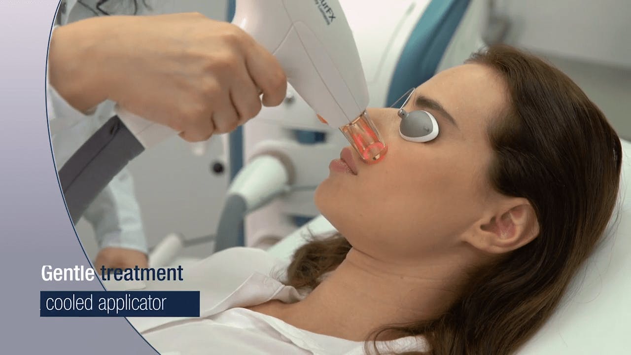 ResurFX | Shapiro Plastic Surgery & Skin Klinic