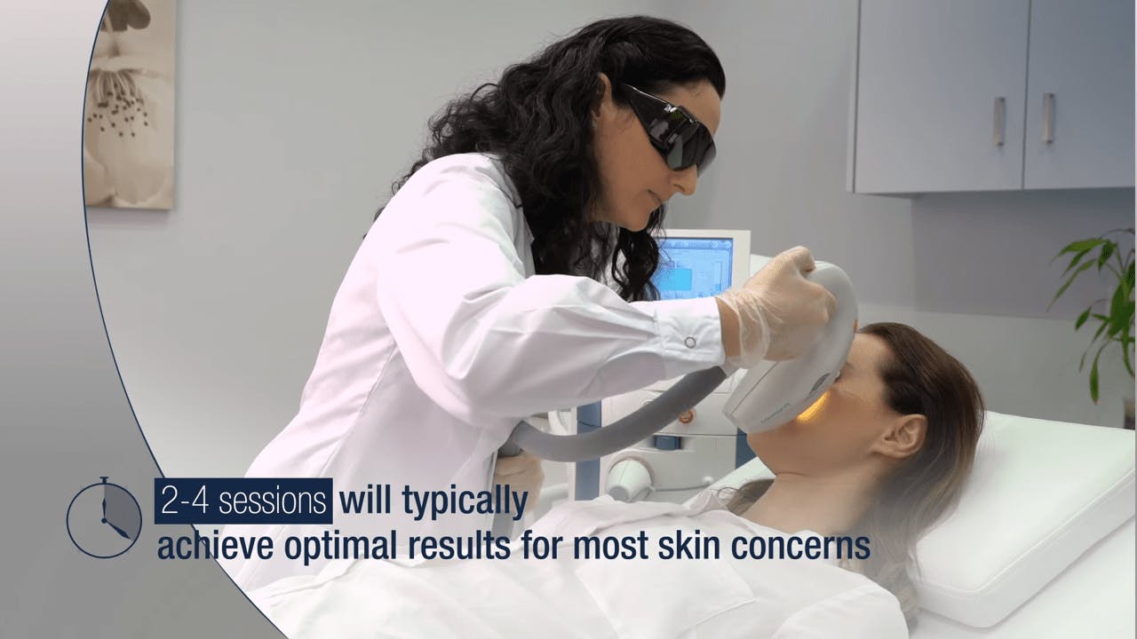 Photo of Lumenis Treatment