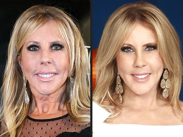 vicki-gunvalson-1-600