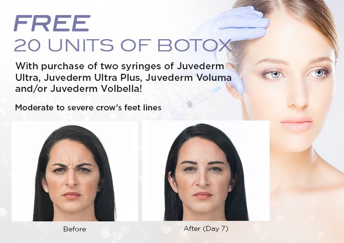 botox-offer-august