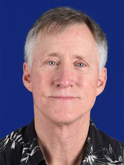 Facial Rejuvenation Before & After Gallery - Patient 18264906 - Image 2