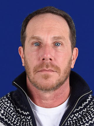 Facial Rejuvenation Before & After Gallery - Patient 18264911 - Image 2