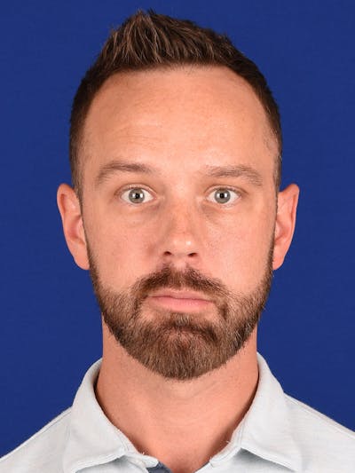 Facial Rejuvenation Before & After Gallery - Patient 18264916 - Image 2