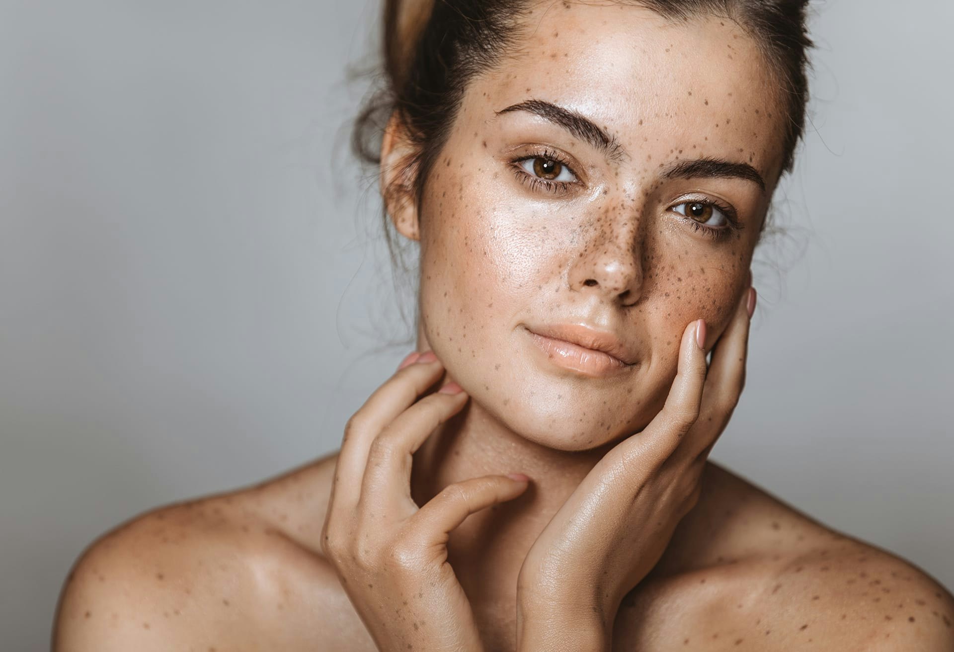 Woman with Freckles