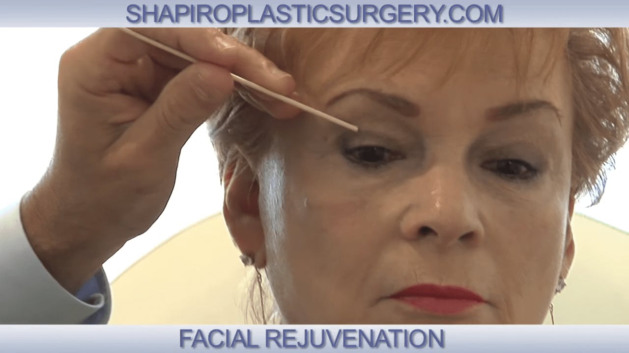 Shapiro Plastic Surgery