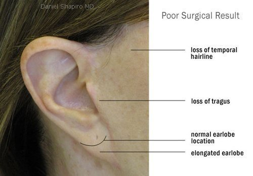 Ear Infographic