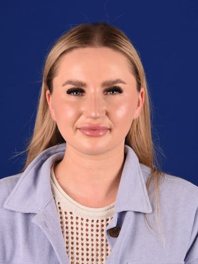 Female Rhinoplasty Before & After Gallery - Patient 243543 - Image 2