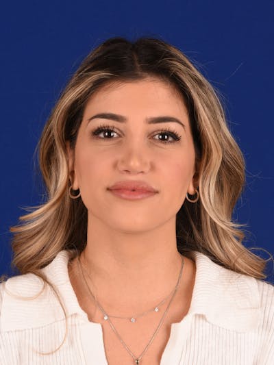 Female Rhinoplasty Before & After Gallery - Patient 323127 - Image 2