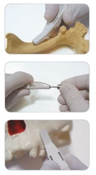 bone scraper instructions