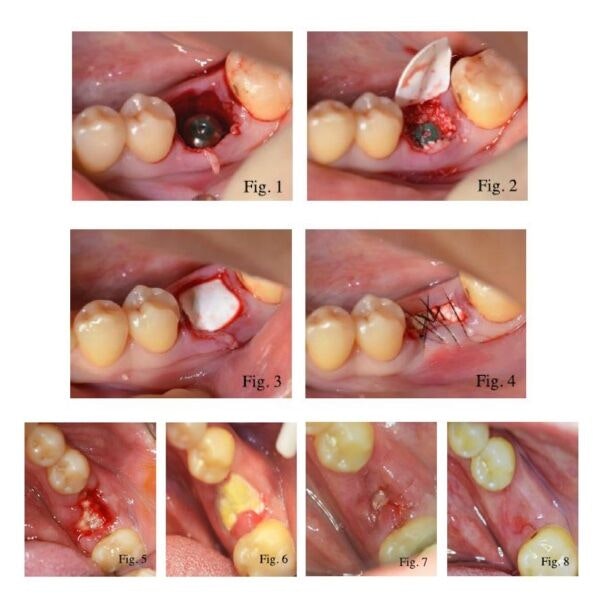 Cytoflex Textured Case