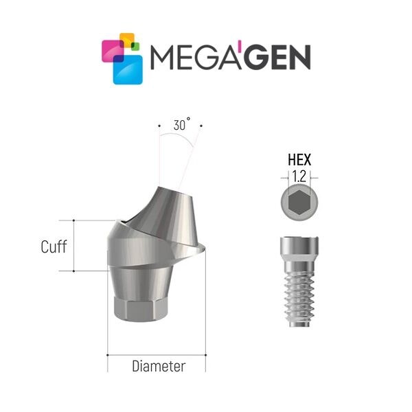 AnyRidge Compatible Multi-Unit 30-Degree Abutment