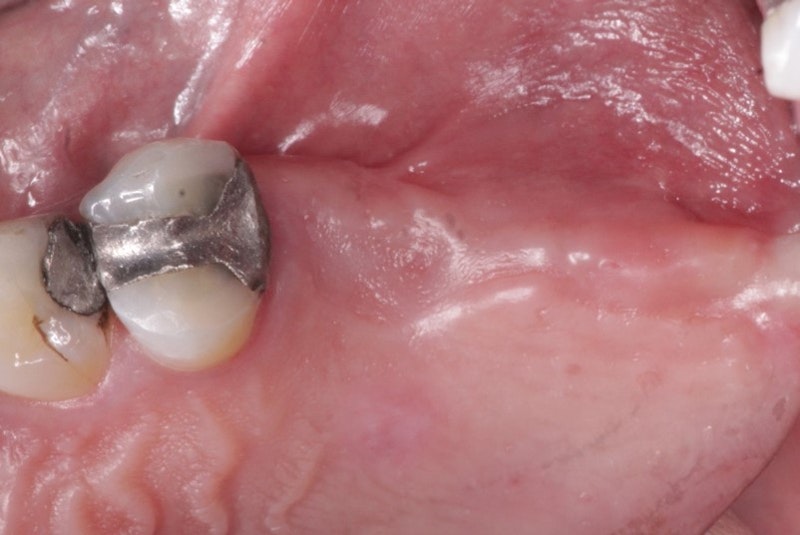 Addressing an OralAntral Communication