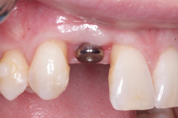 Tissue Contour 1