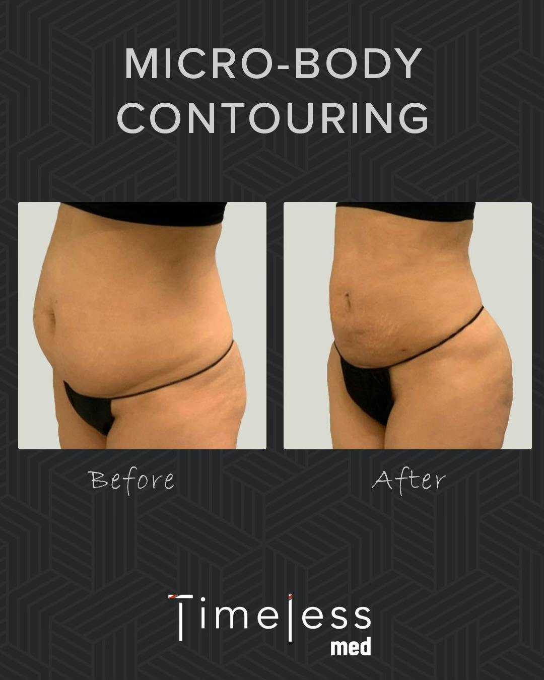 Body Before & After Gallery - Patient 34169873 - Image 1