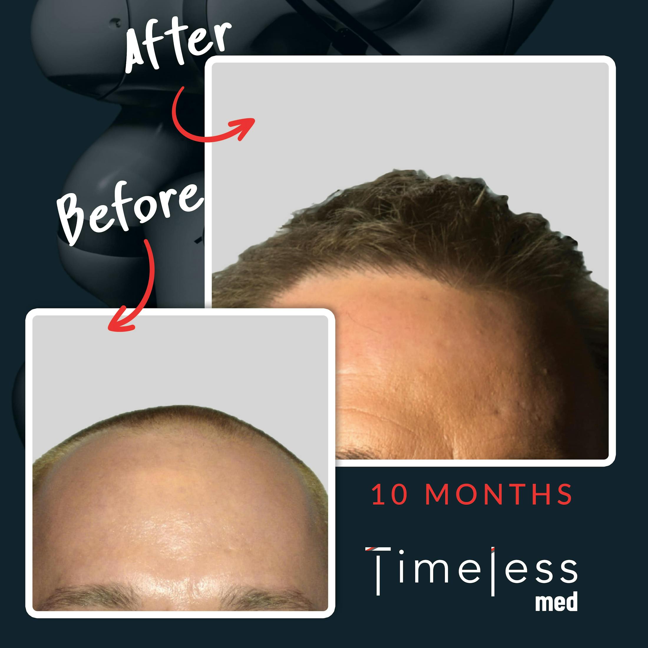 Hair Before & After Gallery - Patient 36412330 - Image 1